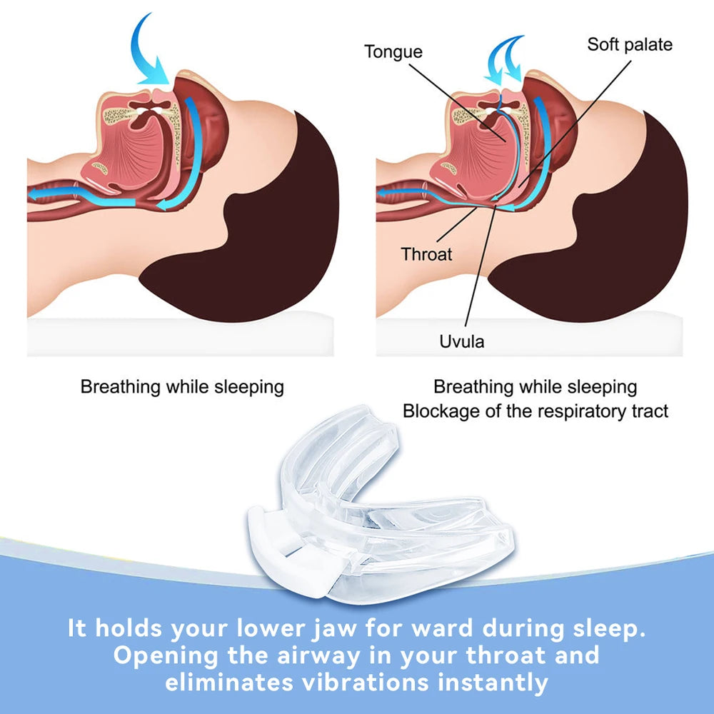 Adjustable Anti-Snoring Bruxism Mouth Guard