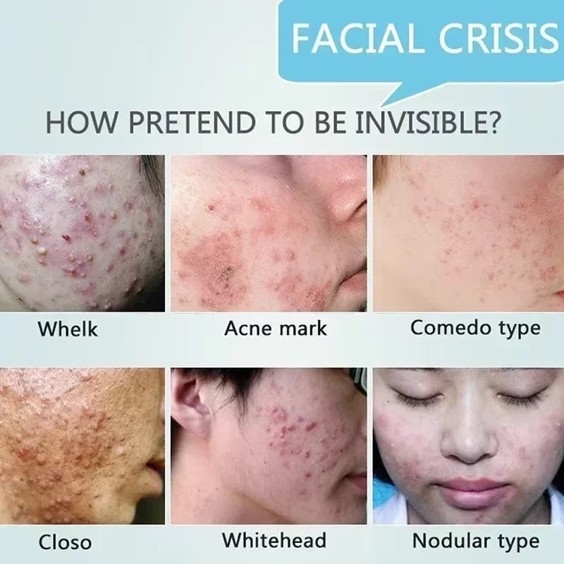 Pore Shrinking & Acne Scar Repair Cream