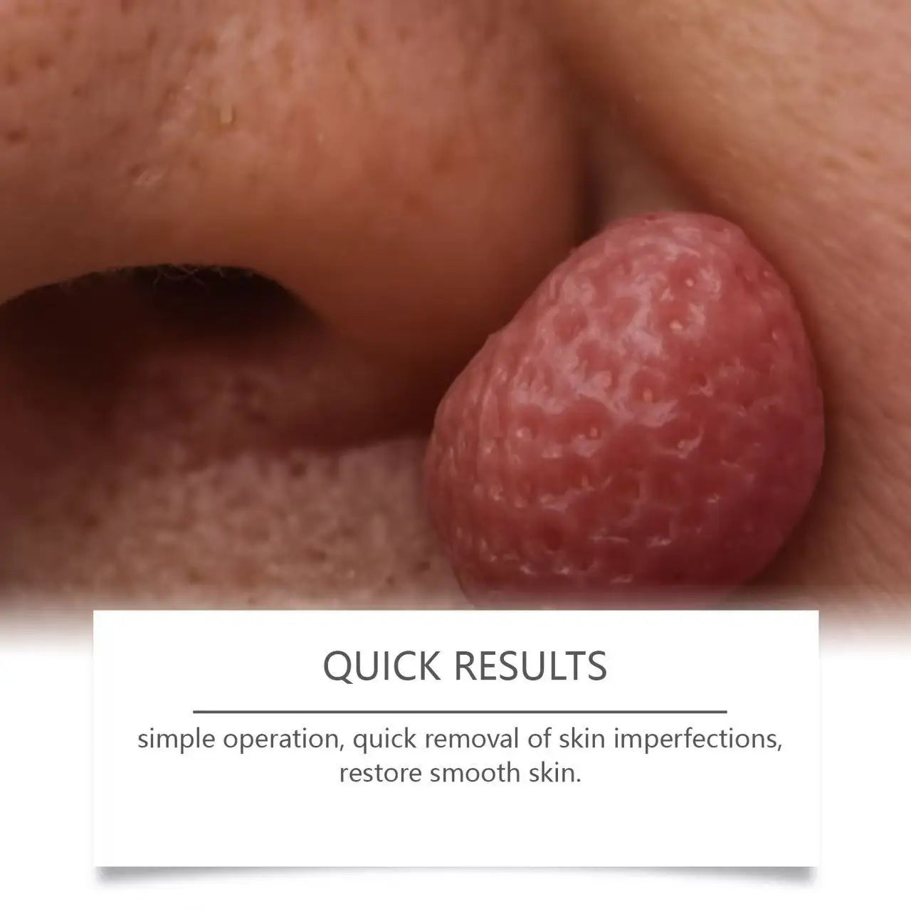 1st Gen Upgraded Wart Repair Serum – Fast Root Removal