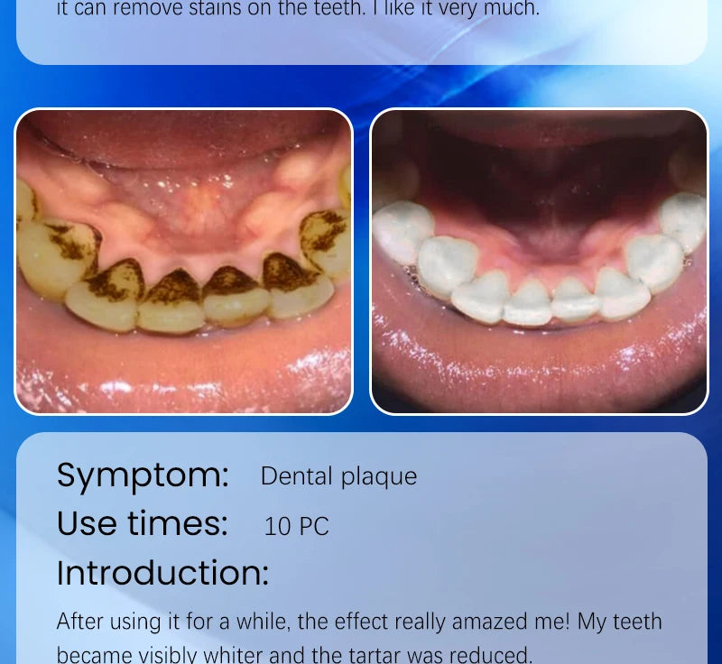 2025 Teeth Whitening & Plaque Cleansing Mineral Powder