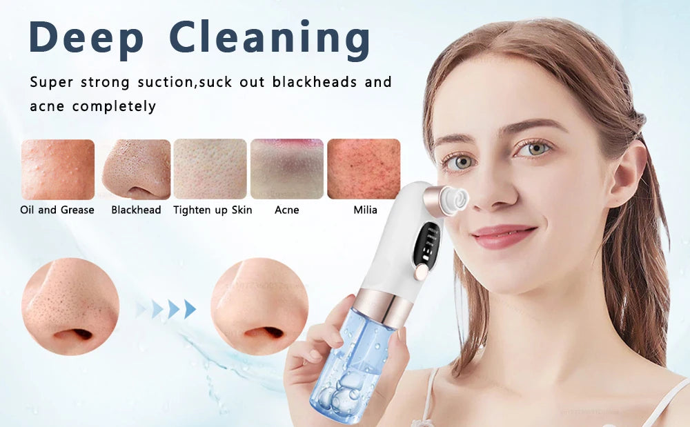 Blackhead Remover Pore Vacuum – Electric Face Cleaner & Pimple Extractor