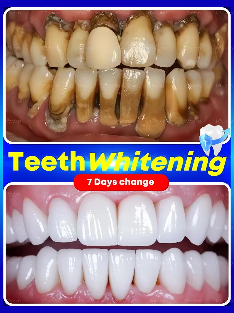 2025 Teeth Whitening & Plaque Cleansing Mineral Powder
