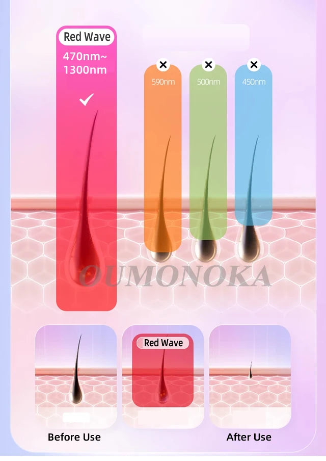 4-in-1 IPL Laser Hair Removal Device