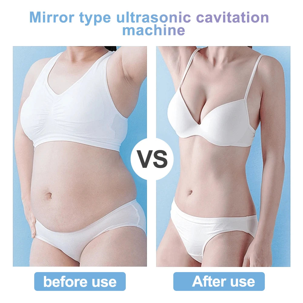 4-in-1 Ultrasonic Cavitation Slimming & Skin Lifting Device