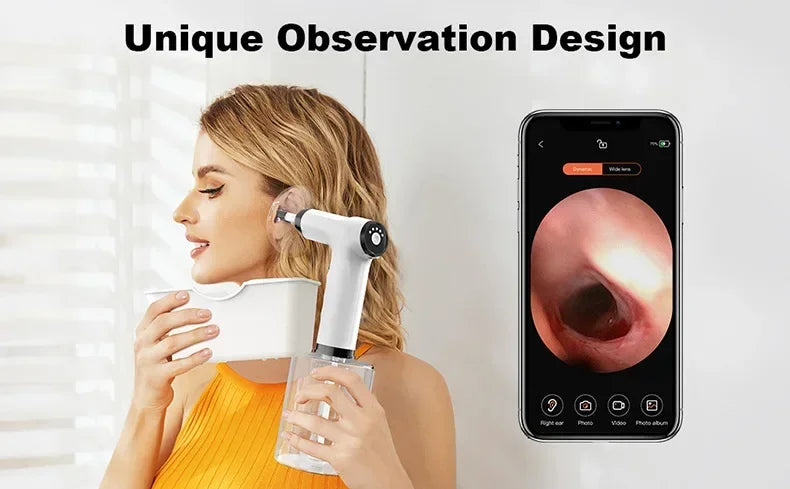 Electric Ear Wax Removal Kit – Soft Spray Irrigator