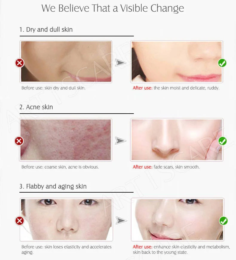 ARTISCARE Vitamin C & Hyaluronic Acid Serum Set – 4PCS Moisturizing Facial Care