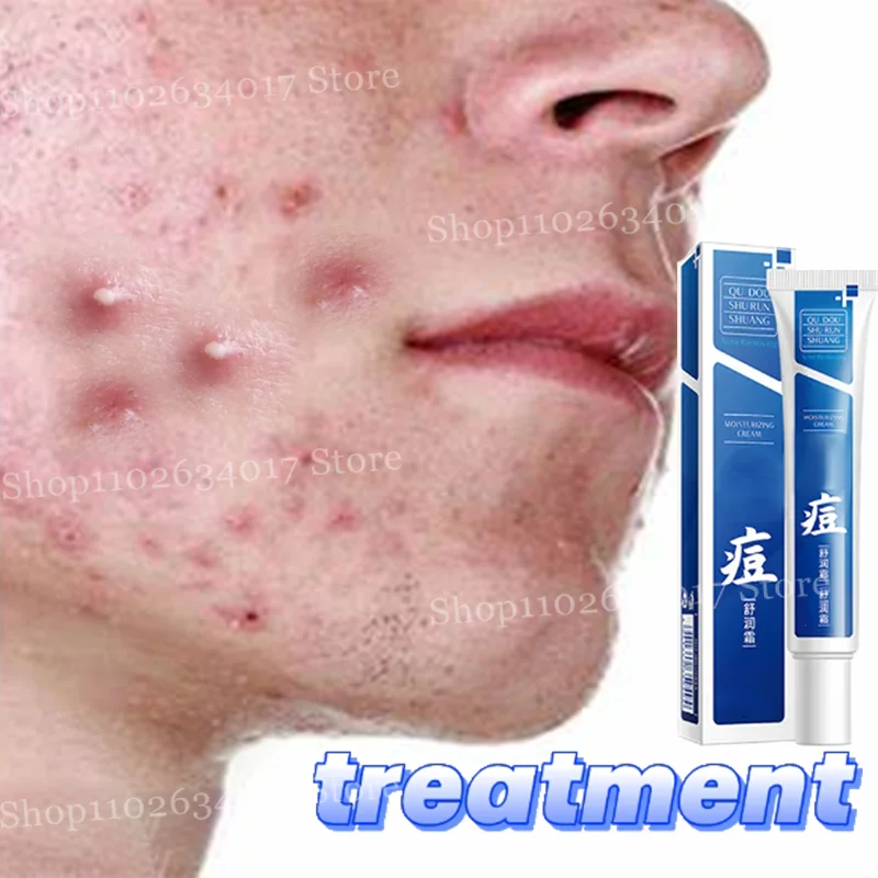 Pore Shrinking & Acne Scar Repair Cream