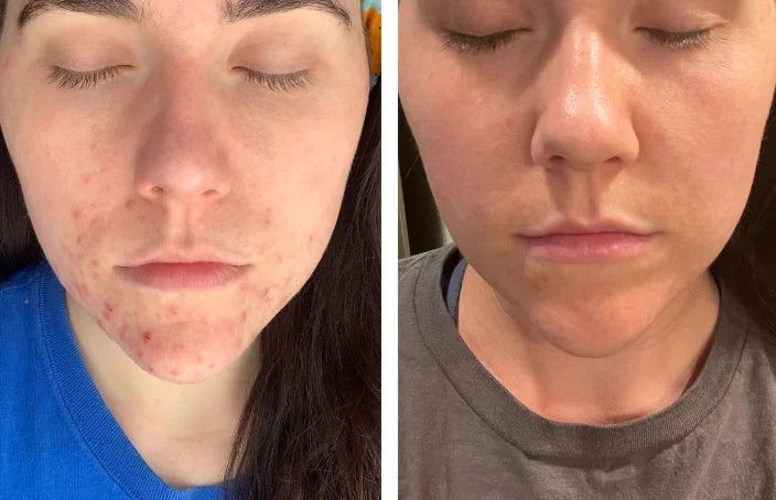 Beef Tallow Moisturizing & Firming Face Cream