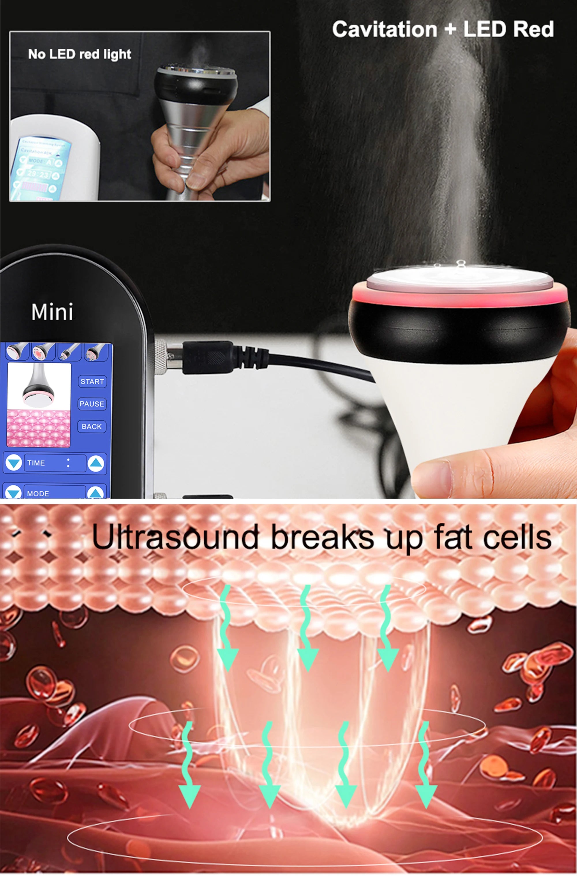 4-in-1 Ultrasonic Cavitation Slimming & Skin Lifting Device