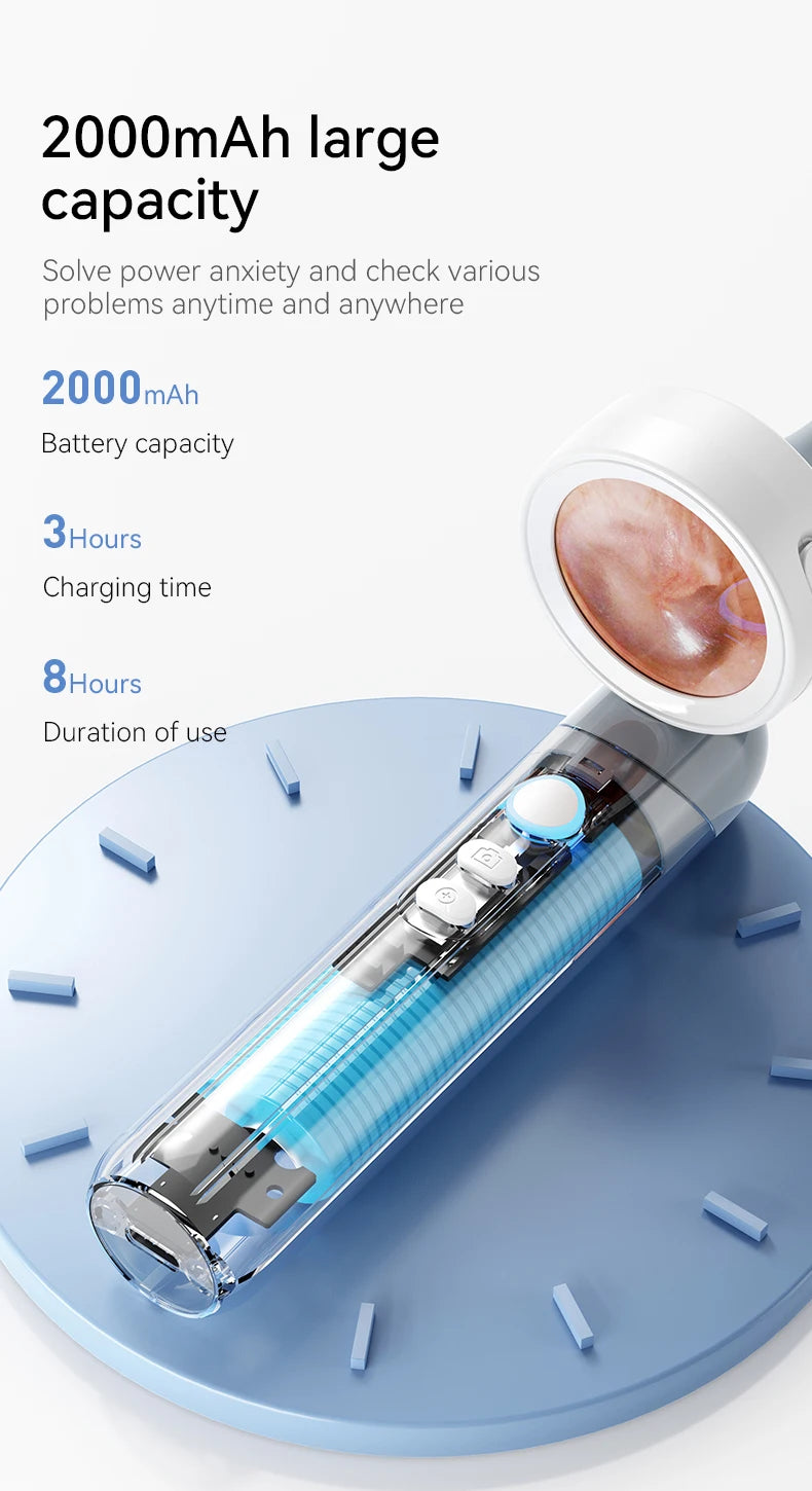 1080P Ear Camera with IPS Display & 12 Replaceable Tips