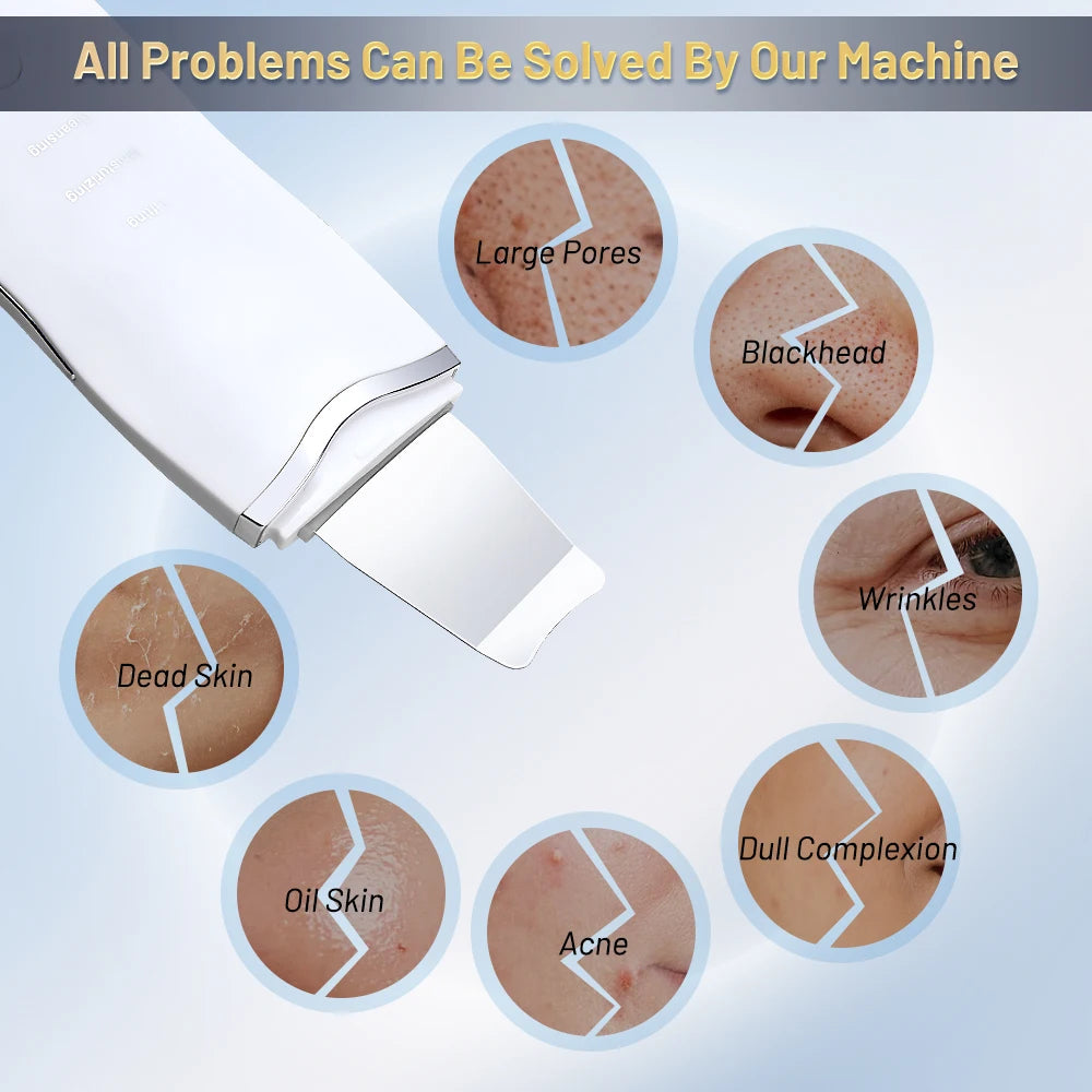 Ultrasonic Skin Scrubber & Deep Pore Cleaner