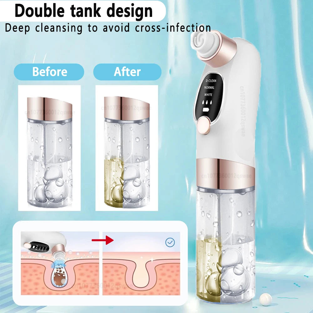 Blackhead Remover Pore Vacuum – Electric Face Cleaner