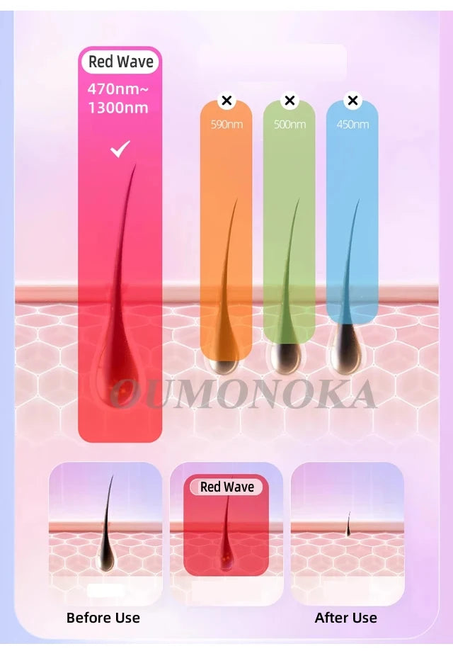 Permanent IPL Laser Hair Removal & Epilator Device