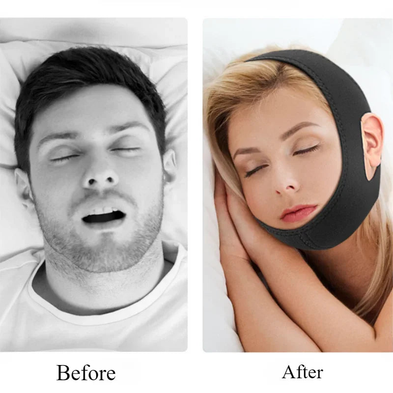 Anti-Snore Chin Strap – Sleep Support & Snoring Aid