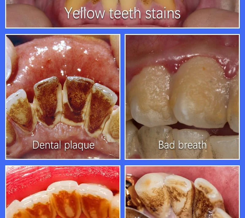 2025 Teeth Whitening & Plaque Cleansing Mineral Powder