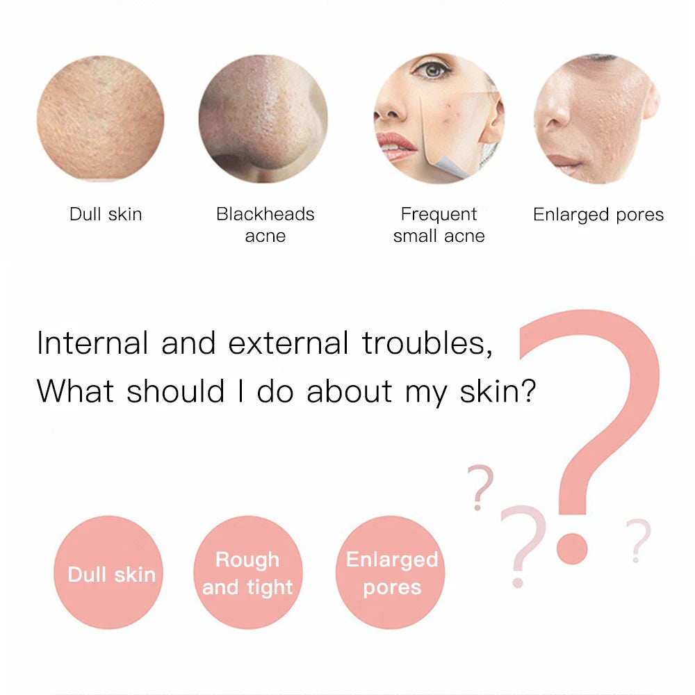 Ultrasonic Skin Scrubber & Deep Pore Cleaner