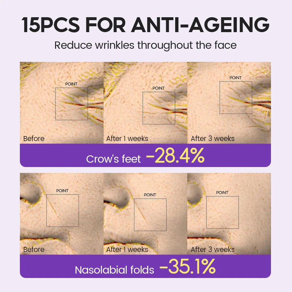 Retinol + Pro-xylane Ampoule Serum – 15pcs