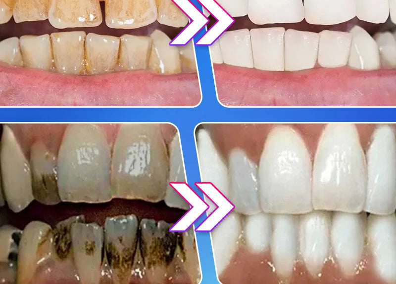 2025 Teeth Whitening & Plaque Cleansing Mineral Powder