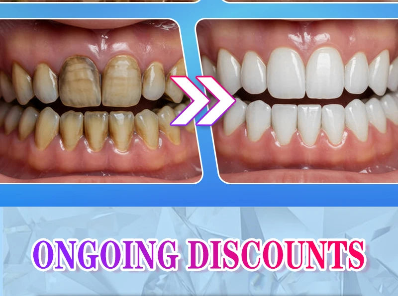 2025 Teeth Whitening & Plaque Cleansing Mineral Powder