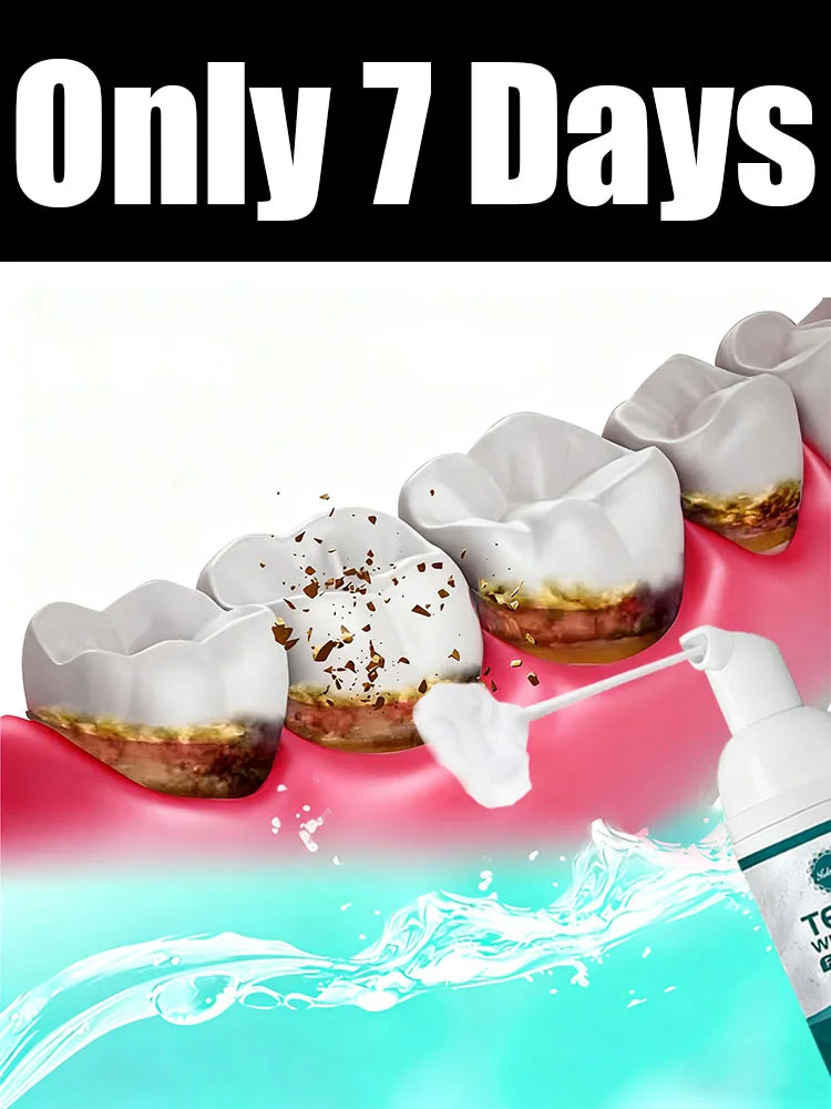 Intraoral Whitening Care Tool – Say Goodbye to Yellowing in 7 Days!