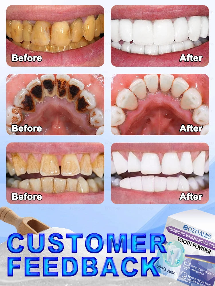 2025 Teeth Whitening & Plaque Cleansing Mineral Powder