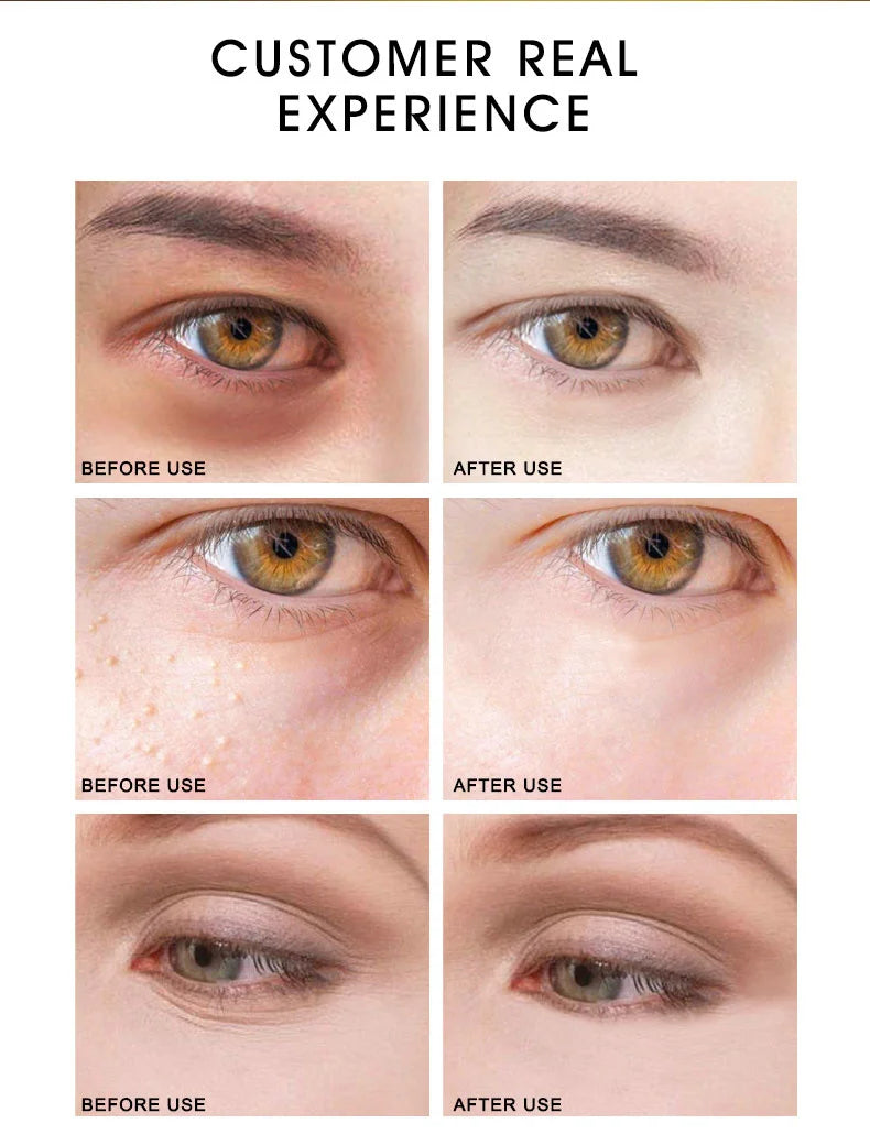 ARTISCARE 24K Gold Serum Set – 3pcs Hydrating & Eye Care Kit