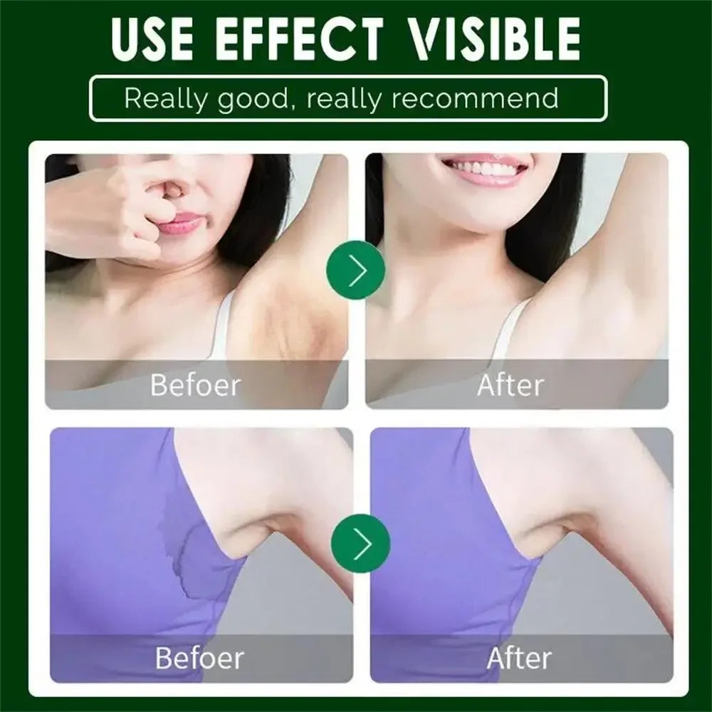 Underarm Odor Removal Cream – Long-Lasting Antiperspirant & Deodorant