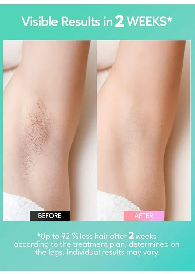 4-in-1 IPL Laser Hair Removal Device