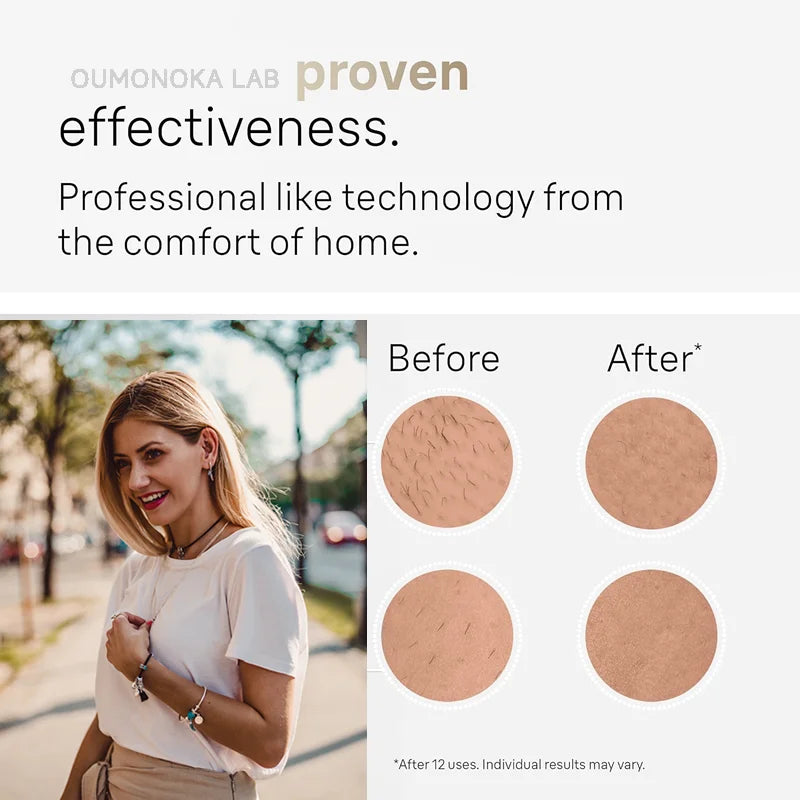 Permanent IPL Laser Hair Removal & Epilator Device