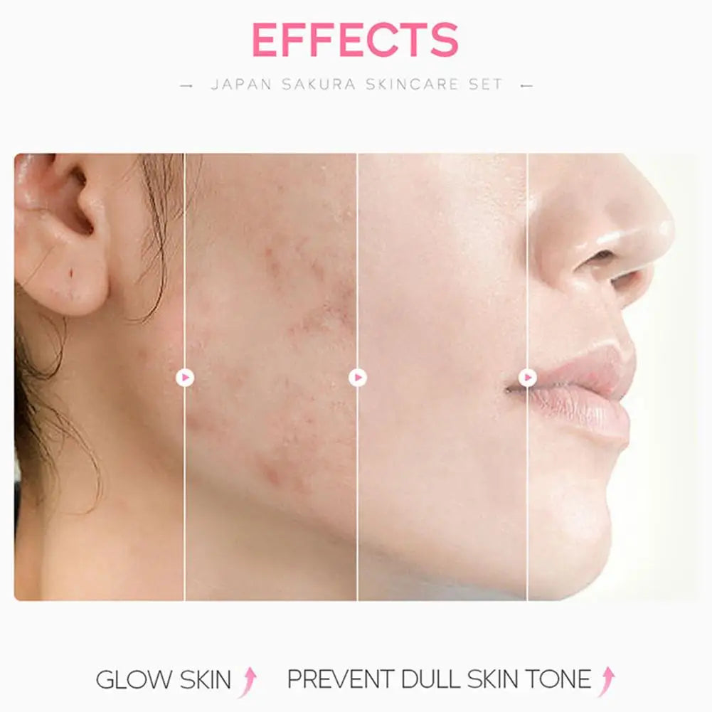 Sakura Skin Care Set – 3/5pcs Facial Care Gift Box