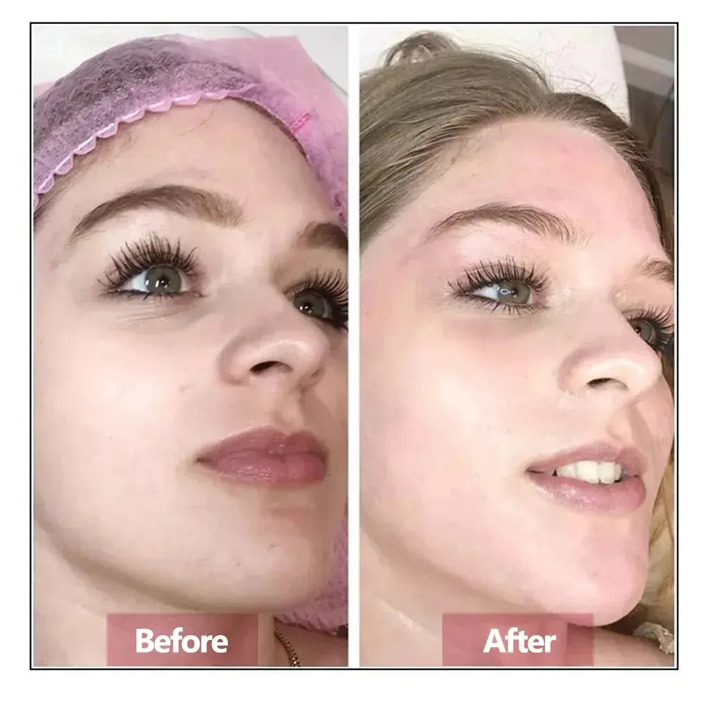 Hyaluronic Acid Hydrating & Firming Face Serum