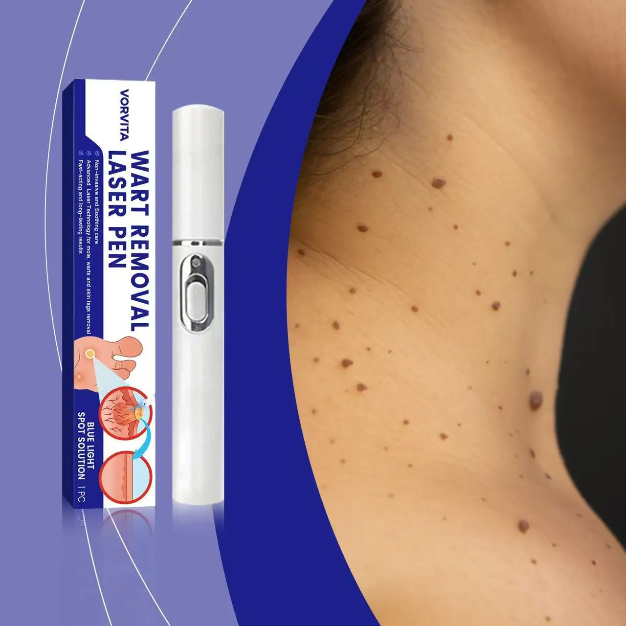 1st Gen Upgraded Wart Repair Serum – Fast Root Removal