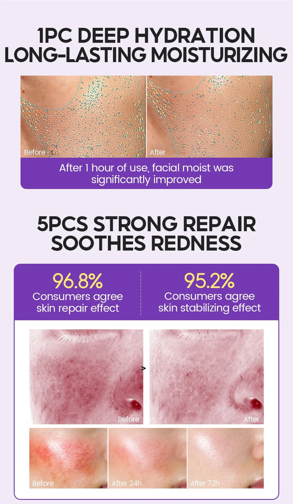 Retinol + Pro-xylane Ampoule Serum – 15pcs