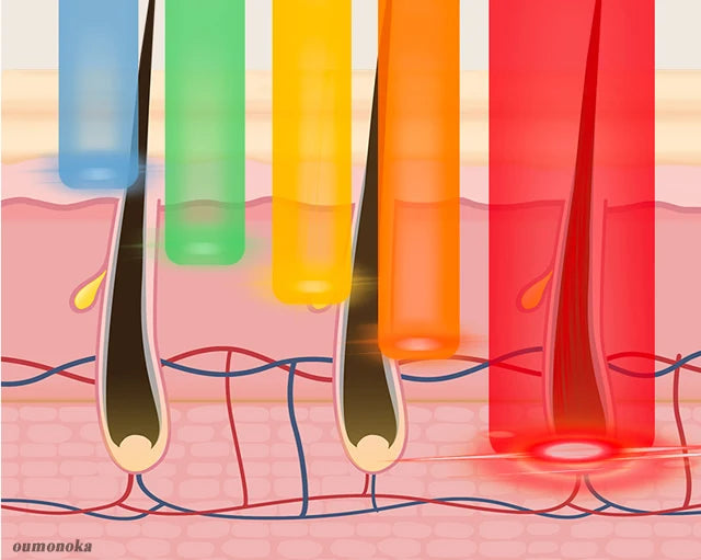 4-in-1 IPL Laser Hair Removal Device