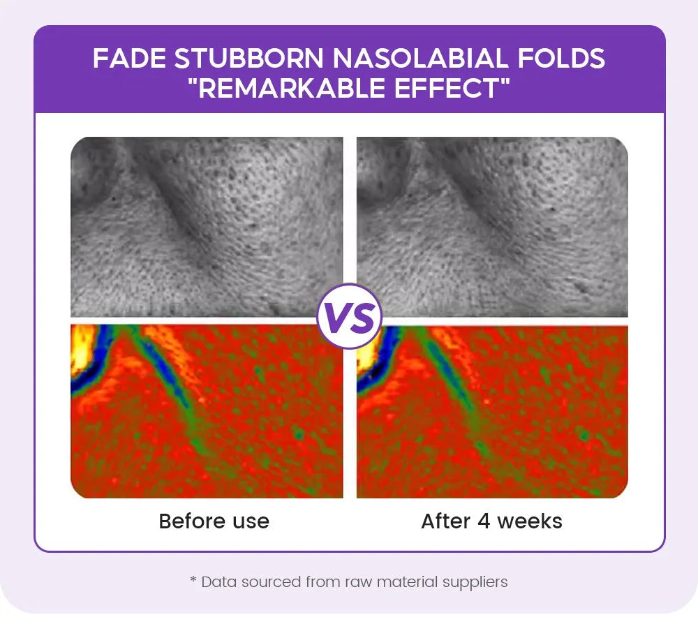 Retinol + Pro-xylane Ampoule Serum – 15pcs