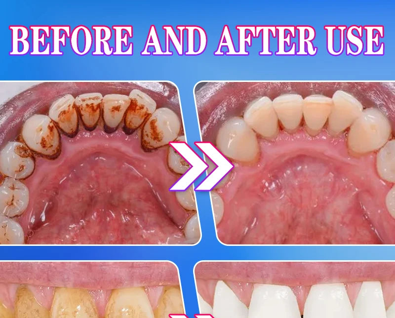 2025 Teeth Whitening & Plaque Cleansing Mineral Powder