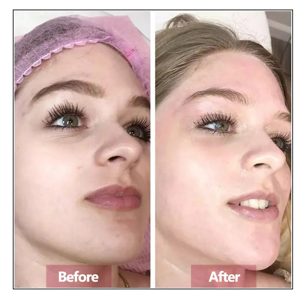 Hyaluronic Acid Hydrating & Firming Face Serum