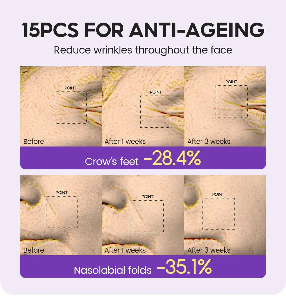 Retinol + Pro-xylane Ampoule Serum – 15pcs