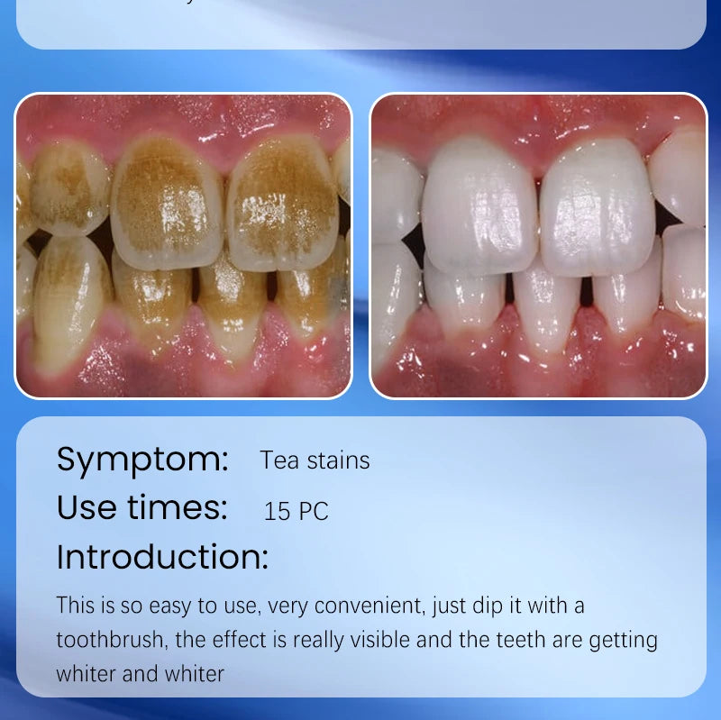 2025 Teeth Whitening & Plaque Cleansing Mineral Powder