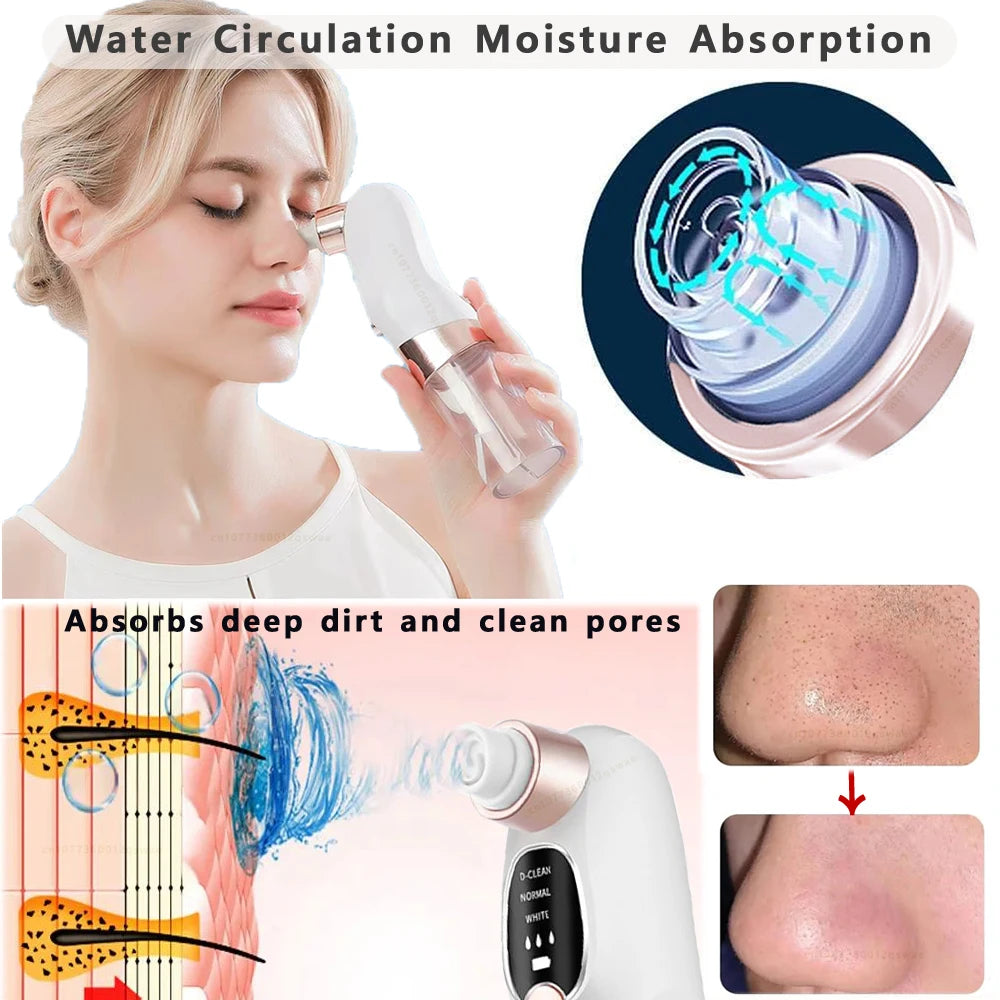 Blackhead Remover Pore Vacuum – Electric Face Cleaner
