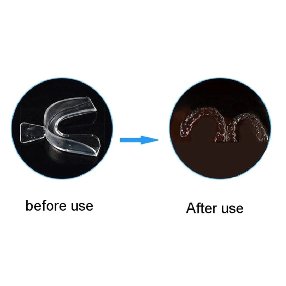 Night Mouth Guard – Anti-Grind & Anti-Snore