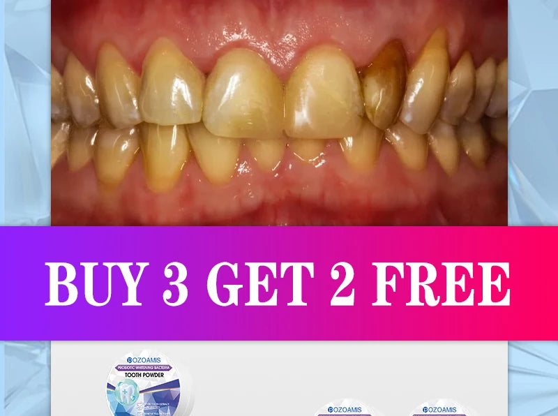 2025 Teeth Whitening & Plaque Cleansing Mineral Powder